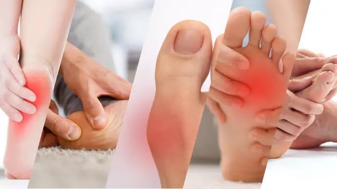  Diagrama que muestra distintos tipos de pisada y su efecto en la alineación del cuerpo.